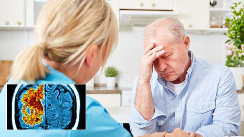  دراسة صادمة تؤكد: الزهايمر يمكن أن ينتقل كعدوى إلى الإنسان!
