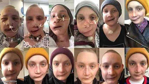ناجية توثق بالصور رحلة شفائها من السرطان