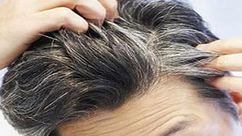 هذه الأمور تؤدي الى الشيب المبكر! عليك أن تتجنبها