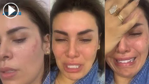  فيديو صادم: أماني السويسي تتعرض لضرب مبرح لثاني مرة وتدخل المستشفى