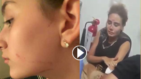 فيديو وصور نجوم أصيبوا بانفجار لبنان ونقلوا للمشفى: نادين، داليدا ودومينيك  
