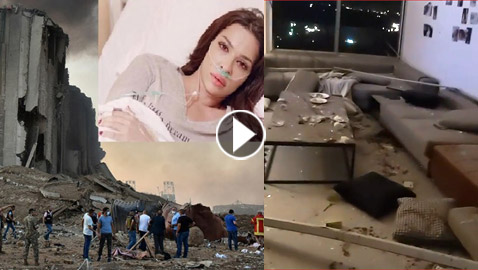 نادين نجيم عقب إصابتها فى انفجار بيروت: بشكر ربي لأنه أعطانى عمرا جديدا