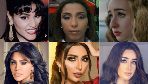 بالصور: نجمات عربيات قبل وبعد تصغير الأنف.. لن تصدق مظهرهن!